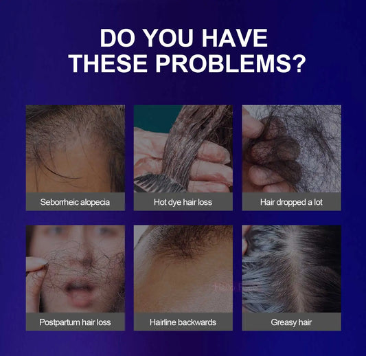 Dunclo Laser Hair Cap – Wissenschaftlich validiert. Sichtbar dichteres Haar.